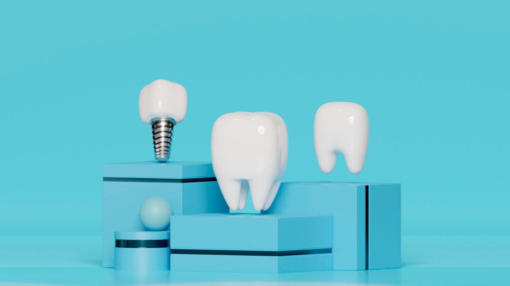 Exocad DentalCAD